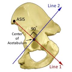 Acetabular quadrants are formed from a line extending from the ASIS (Marker A) through the center of the acetabulum (Marker C) to the posterior fovea, forming acetabular halves. The second line is drawn perpendicular to the first at the center of ...