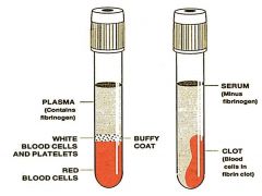 Plasma
contains anticoagulant, unclotted cellular components collect at bottom of tube, liquid portion (plasma) is straw colored. Will be layered in tube from top to bottom: plasma, buffy coat, RBCs
 
Serum
does not have anticoagulants, cellular c...