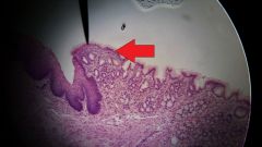 What specific tissue type is found at the tip of the red arrow?