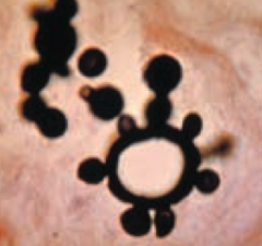 Paracoccidioidomycosis
- Budding yeast with "Captain's Wheel" formation (much larger than RBCs
- "Paracoccidio parasails with the captain's wheel all the way to Latin America"