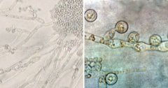 Dimorphic yeast
- Pseudohyphae and budding yeasts at 20°C
- Germ tubes at 37°C