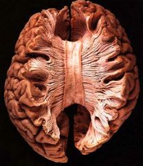 Vad gör hjärnbarken (corpus callosum)?