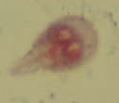 Giardia lamblia (GI protozoa)
- Transmitted via cysts in water
- Diagnose by presence of trophozoites or cysts in stool
- Treat with Metronidazole