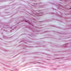 -Parallel collagen
-Little ground substance
-Few fibroblasts
-Tendons, Ligaments, Aponeuroses