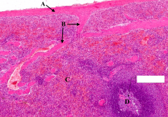 White Pulp of spleen (blue/purple staining area)