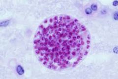 Toxoplasma gondii (bradizoito)