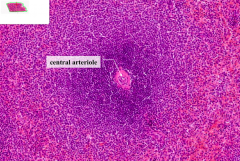 Periarterial Lymphatic Sheath (PALS)