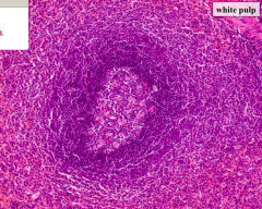 Periarterial Lymphatic Sheath (PALS) contains lymphoid follicles composed of B cells