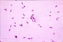 Toxoplasma gondii (taquizoitos) 