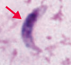 Toxoplasma gondii (protozoa)
- Transmitted via cysts in meat or oocysts in cat feces; crosses placenta (pregnant women should avoid cats)
- Diagnosed via serology and biopsy (tachyzoite - picture)
- Treat with Sulfadiazine + Pyrimethamine