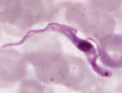 Trypanosoma brucei (protozoa)
- Transmitted via Tsetse fly, a painful bite
- Diagnose via blood smear (picture)
- Treat with SURamin for blood borne disease or MELAsoprol for CNS penetration ("it SURe is nice to go to sleep" - MELAtonin helps w...