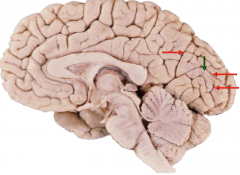 extrastriate cortical areas