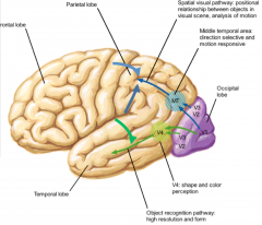 inferior temporal lobe