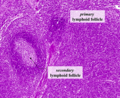 - A = Secondary Lymphoid Follicle
- B = Primary Lymphoid Follicle