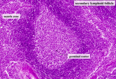Secondary Lymphoid Follicles
- Germinal center = lightly staining center
- Mantle zone = darker staining periphery