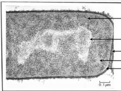 Identify structures from 2.2.1 in electron micrographs of E. coli. 