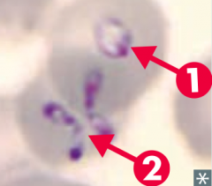 - Blood smear: ring form (1) and "Maltese cross" (2)
- PCR