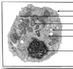 Identify structures from 2.3.1 in electron micrographs of liver cells. 