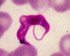 Trypanosoma cruzi (protozoa)
- Transmitted via Reduviid bug ("kissing bug") feces, deposited in a painless bite (much like a kiss)
- Diagnosed via blood smear (picture)
- Treat with Benznidazole or Nifurtimox