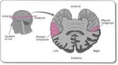 Area of temporal cortex that is larger in the left hemisphere of 65% of ppl from birth. People with with tend to be right handed