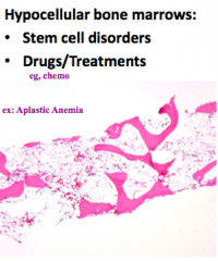 - Stem cell disorders (eg, aplastic anemia)
- Drugs / treatments (eg, chemo)