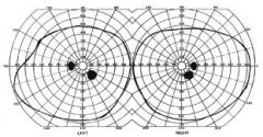 a contour line in visual fields representing connecting points of retinal sensitivity