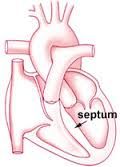 the Septum