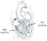 The ventricles.