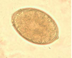 D. latum
infective
diagnostic


**Has operculum+ small knob


***Largest tapeworm found in man