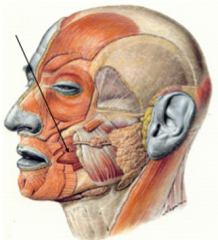O:
- raphe pterygomandibularis
- laterale oppervlak van de processus alveolaris van de maxillae
-mandibula (thv laatste molaren)
I: verzels lopen horizontaal en mediaalwaarts en insereren in de boven en onderlip en in de mondhoeken.
F: - geeft ste...