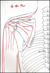 -holds the affected shoulder lower and rotated forward (slouched)
-inferior medial border of the scapula tends to be prominent
-decreases height of subacromial space