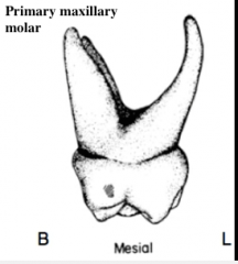 a typical permanent maxillary molar