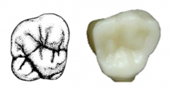maxillary 2nd molar