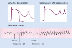 delayed action potential leads to prolonged Q-T interval. Because of the delayed action potential (specifically repolarization), cells fail to repolarize and begin to “flash” at 300 bpm