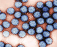 Rotavirus = Right Out The Anus
- Type of Reovirus
- Segmented dsRNA virus
- Major cause of acute diarrhea in US during winter, especially at day-care centers, kindergartens