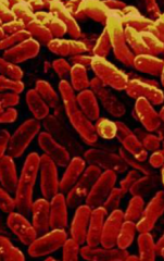 1. Is it alive? Escherichia coli bacteria (e.coli)