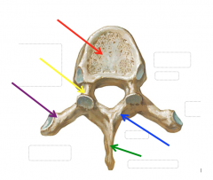 Name the regions of the bone highlighted by the arrows.