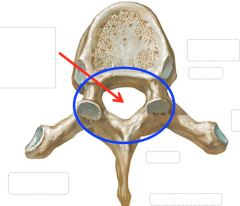 The vertebral foramen
The pedicles and lamina create the vertebral arch