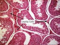 I vilka celler bildas testosteron (i testiklarna)