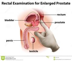 Vad gör prostatan?