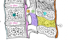 Anterior Longitudinal Ligament (ALL)-light blue
Posterior Longitudinal Ligament (PLL)-pink
Ligamentum flavum-purple
Interspinous ligament-yellow
Supraspinous Ligament-Orange