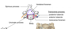 The small bodies and large vertebral foramen are due to the decreased weight and large spinal cord. These also have the upturned lips of the uncinate processes that form uncovertebral joints (joints of Luschka) that are synovial lateral joints. Th...