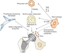 IL-1 is associated with macrophage induced osteolysis surrounding implants. Macrophages -> the inflammatory cascade associated with aseptic loosening of  implants by secreting ->(PDGF), (PGE2), TNF-alpha, IL-1, and IL-6. the primary cells involved...