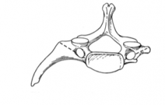 It is the vertebra prominens because it has an especially long spinous process. It also has a cervical rib from the anterior tubercle in about 0.5-1% of the population.