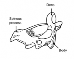 The second cervical vertebra (C2)