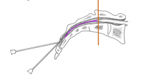 The end of the dural sac of the spinal cord within the sacral canal.