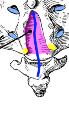 The posterior inferior triangular gap headed by cornua "horns" providing an exit for the filum terminale externum also known as coccygeal ligament.