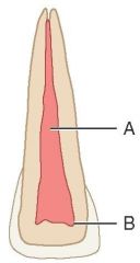 maxillary central incisor