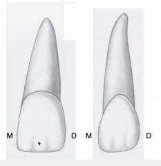 is usually equal to or longer than the maxillary central incisor root 