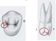 maxillary 1st  premolar (on the mesial side)